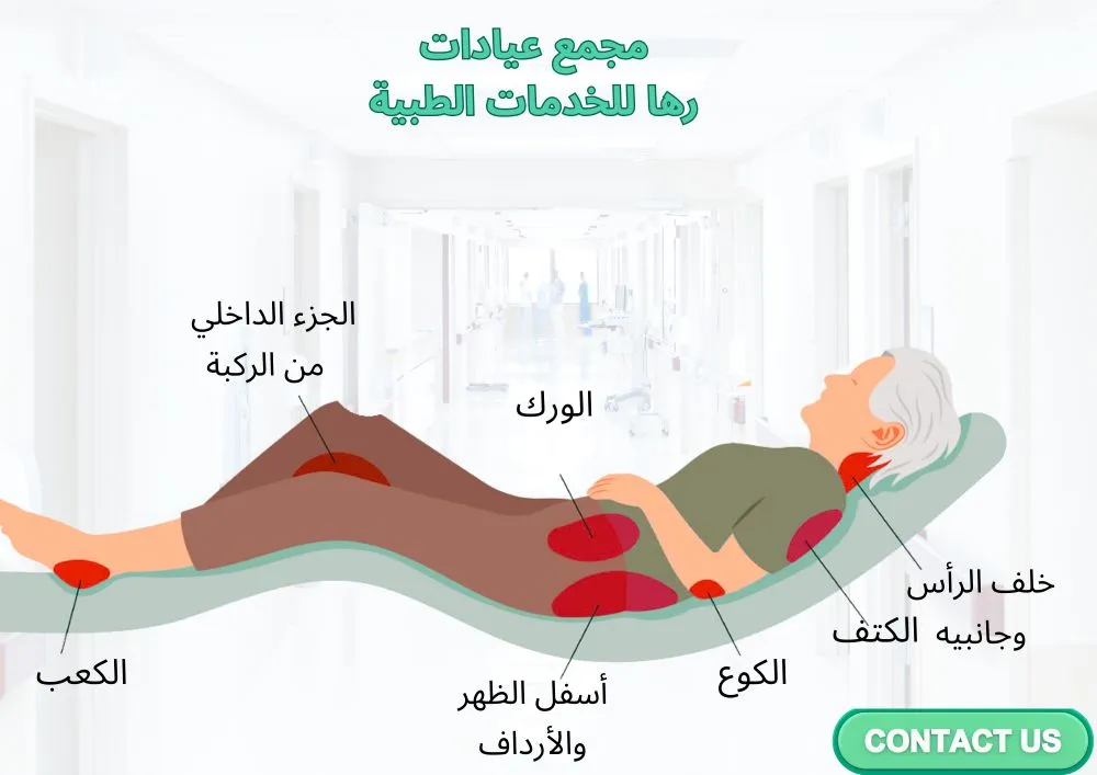 ما هي قرح الفراش؟